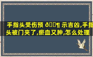 手指头受伤预 🐶 示吉凶,手指头被门夹了,瘀血又肿,怎么处理